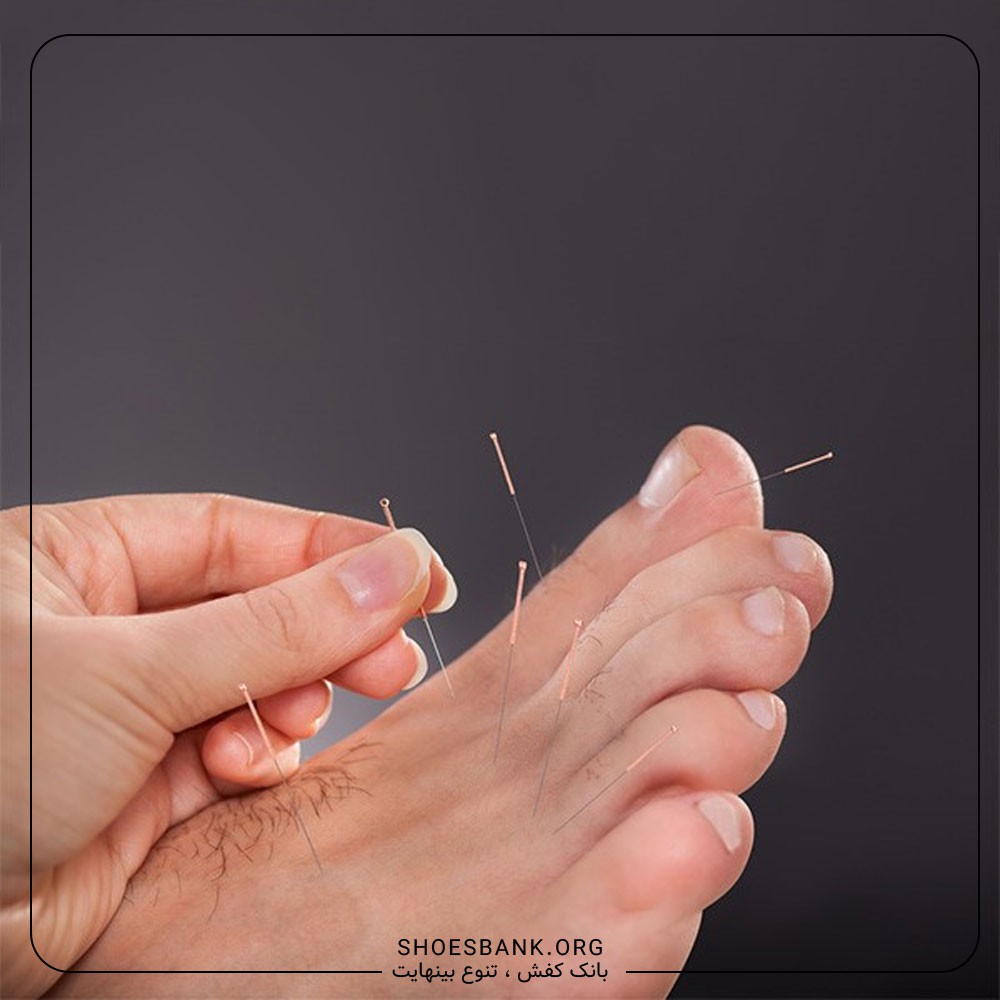 طب سوزنی- بانککفش